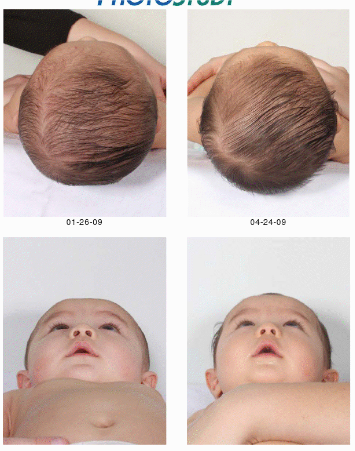826 New baby headband for flat head 467 No tummy time=Flat Head? Frustrated!   Page 3   BabyCenter 