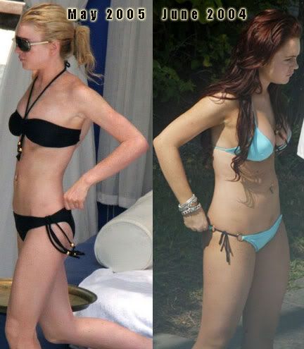 before & after: lohan Pictures, Images and Photos