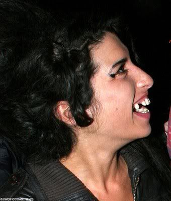 before and after crack pictures. amy winehouse efore and after