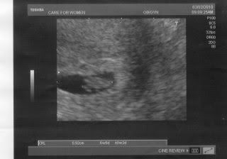 6 weeks