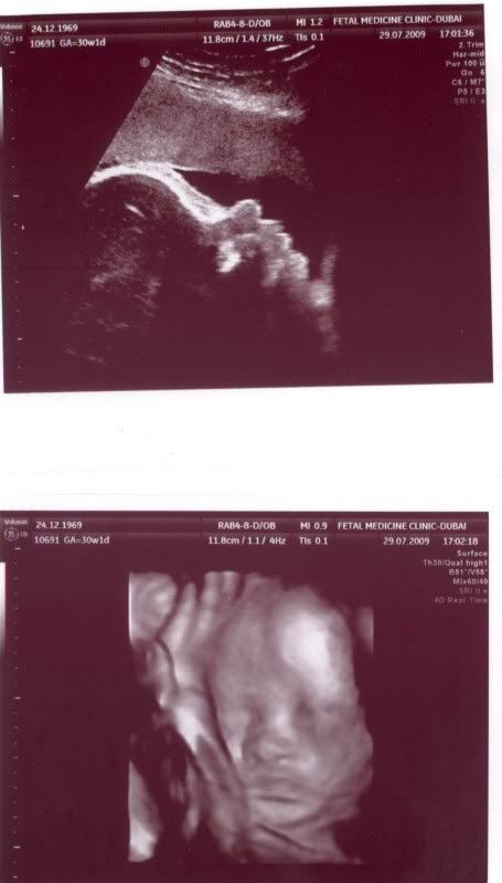 July 29th - 30 week scan - all