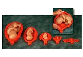 uterus-fetus-model